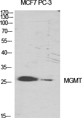 WB - MGMT Polyclonal Antibody AP70933